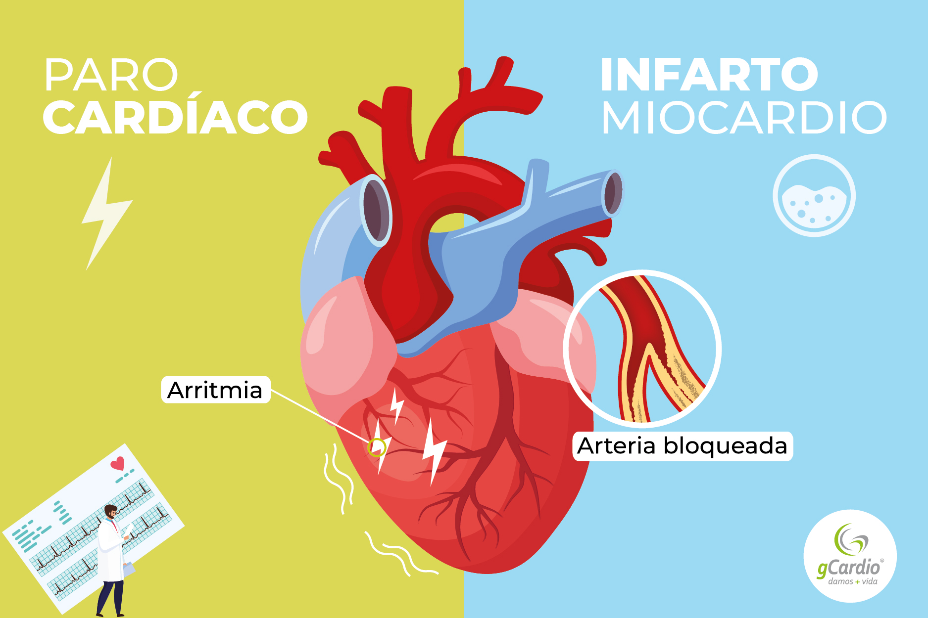 ¿Sabe la diferencia entre un paro cardíaco y un infarto?